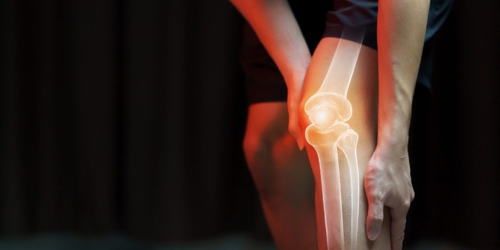 Slide Global Adjustable Knee Sleeve